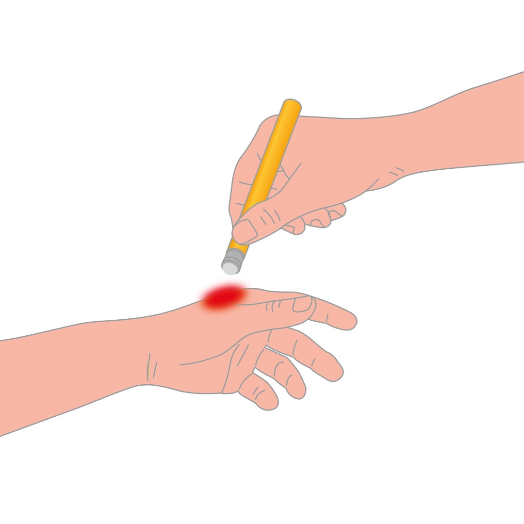 Εικόνα 3 από 7 — AFTER BITE ΓΙΑ ΜΕΤΑ ΤΟ ΤΣΙΜΠΗΜΑ ΣΤΙΚ 16ml